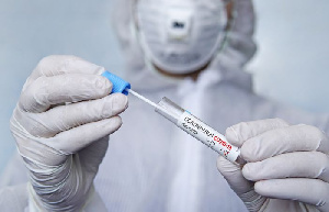 Бизнес просит льгот на тестирование работников