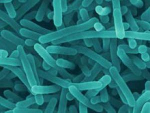 В магазинах Псковской области обнаружено мясо с бактериями, вызывающими пищевую инфекцию