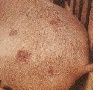 В Тульской области в мясе выявлен возбудитель рожи свиней, опасный для человека В Тульской области в мясе выявлен возбудитель рожи свиней, опасный для человека
