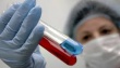 В Болгарии обнаружен второй очаг птичьего гриппа