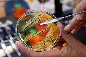 Заболеваемость сальмонеллезом в Германии неуклонно падает